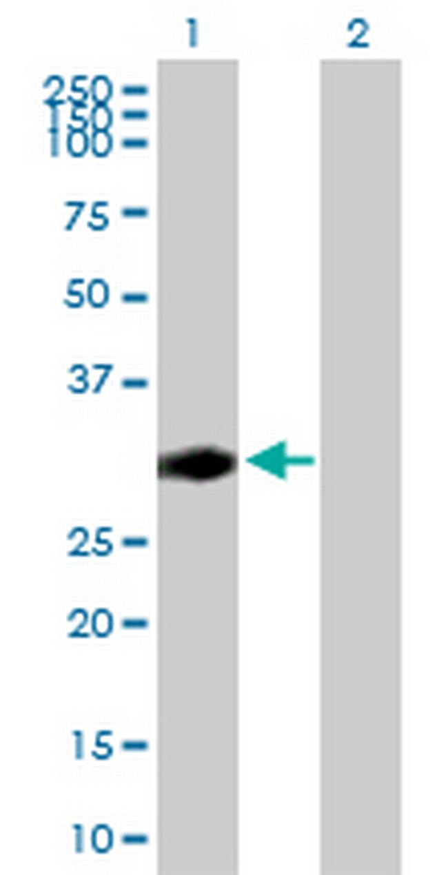 CENPP Antibody in Western Blot (WB)