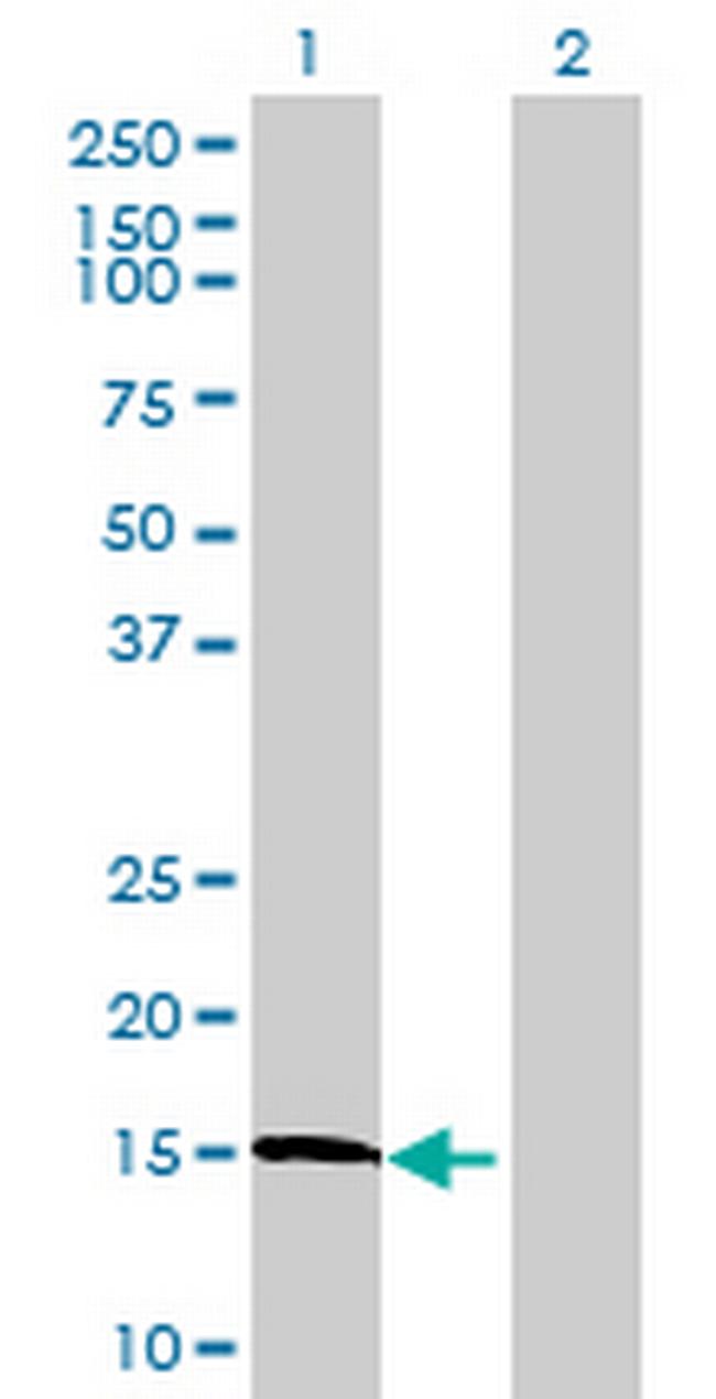 LOC402176 Antibody in Western Blot (WB)