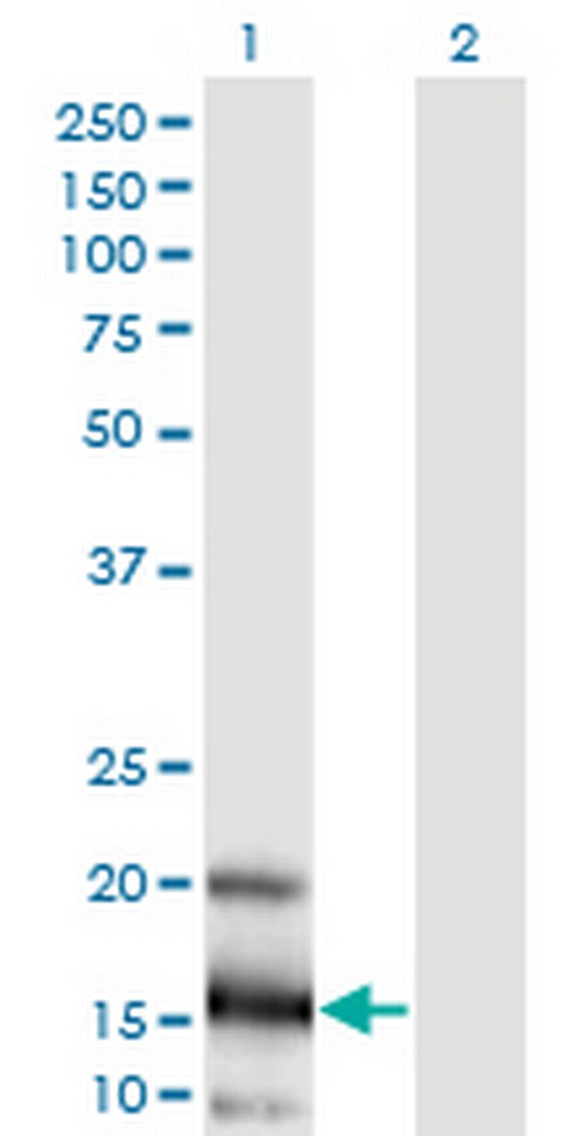 LOC402176 Antibody in Western Blot (WB)