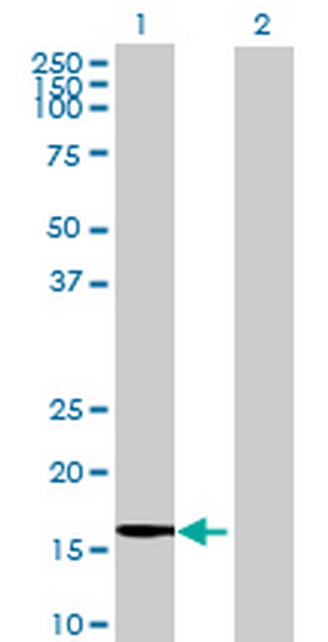 MGC70870 Antibody in Western Blot (WB)