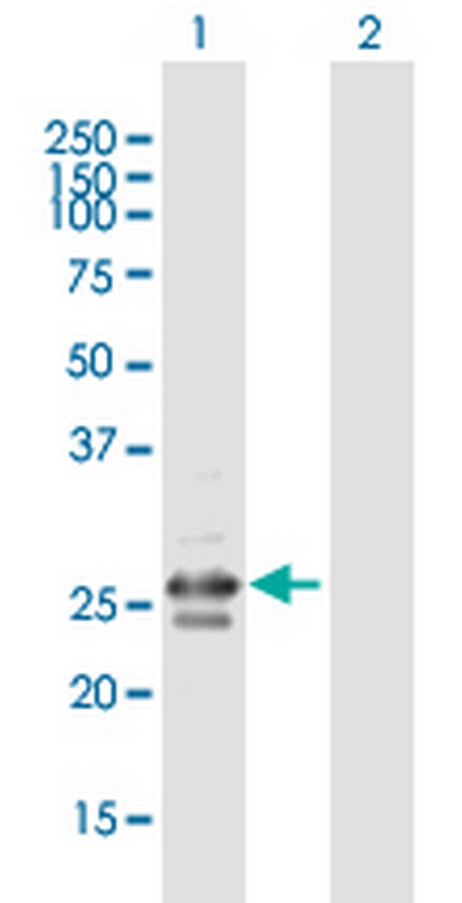 C5orf40 Antibody in Western Blot (WB)