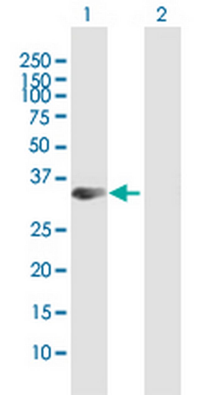 STX19 Antibody in Western Blot (WB)