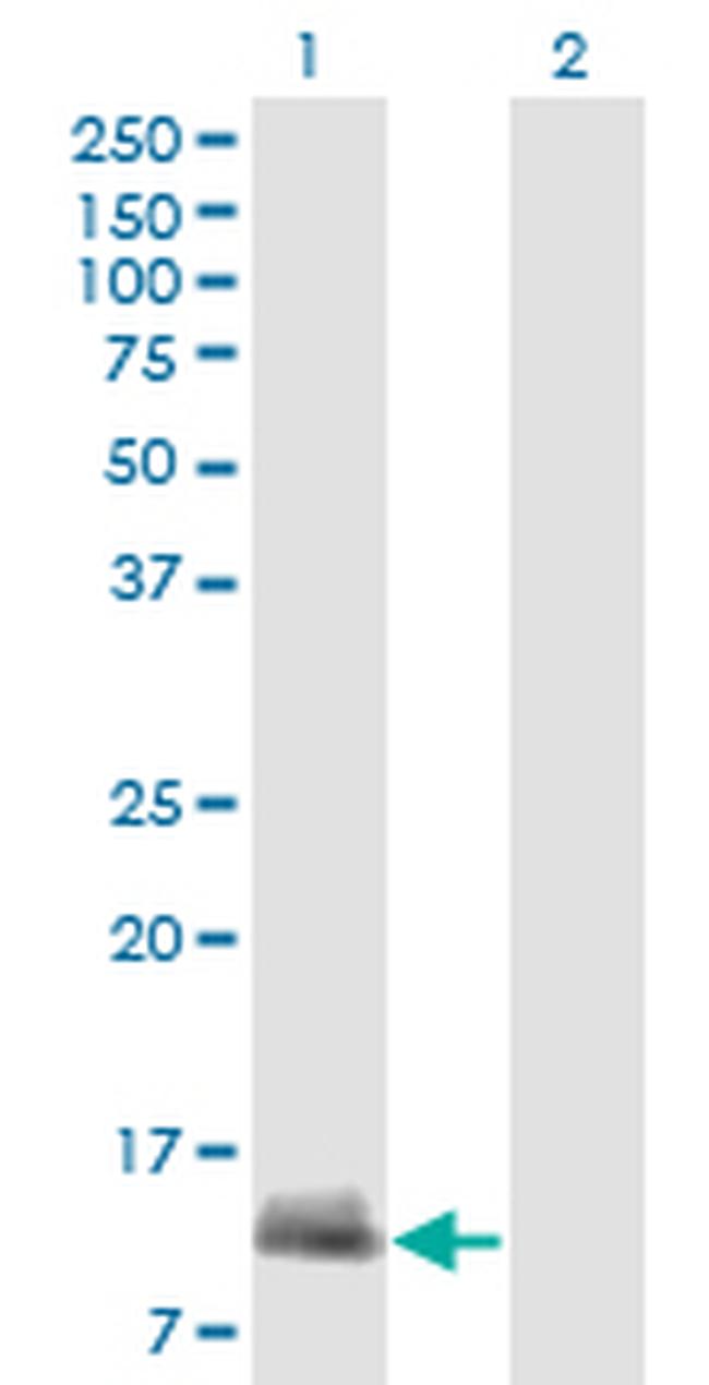 CARD17 Antibody in Western Blot (WB)