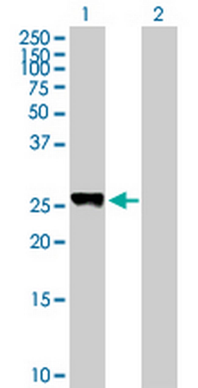 PLEKHM1P1 Antibody in Western Blot (WB)