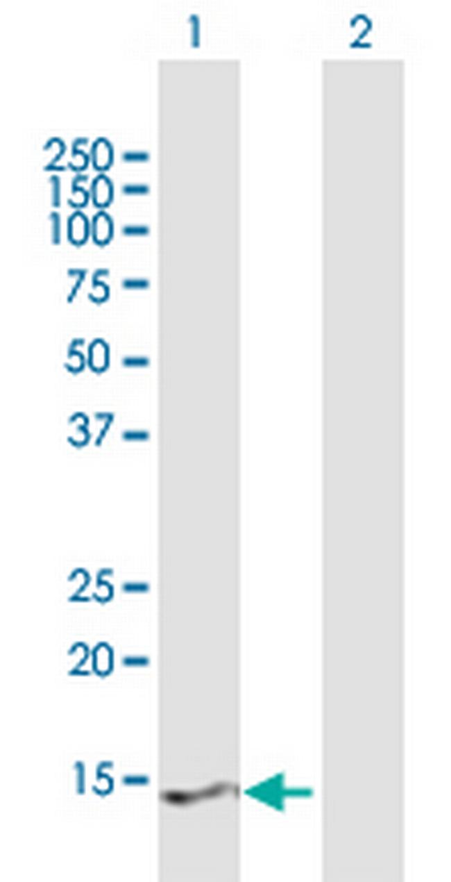 PRY2 Antibody in Western Blot (WB)