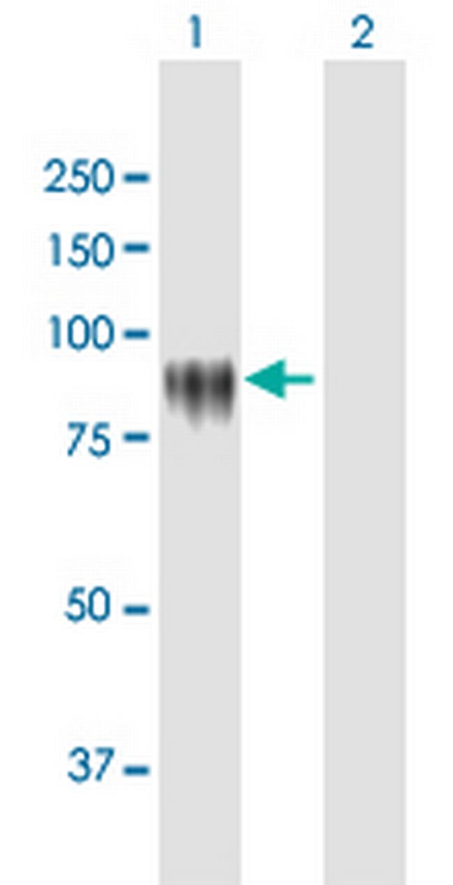 KPRP Antibody in Western Blot (WB)