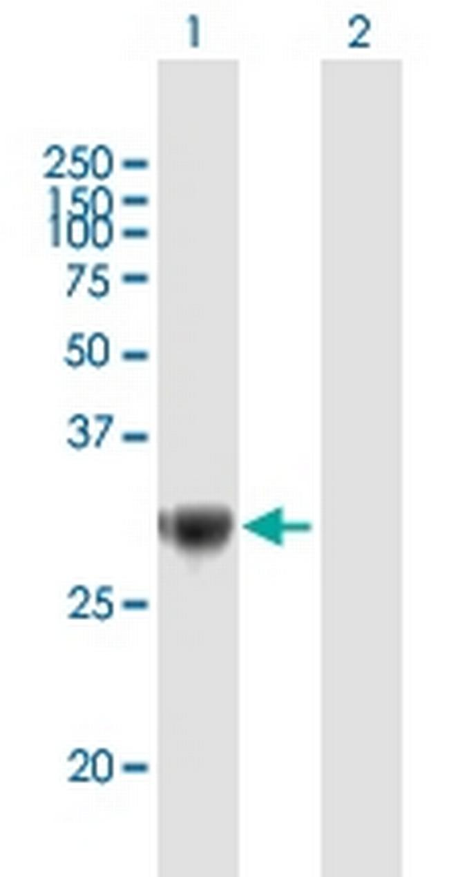TRIM72 Antibody in Western Blot (WB)