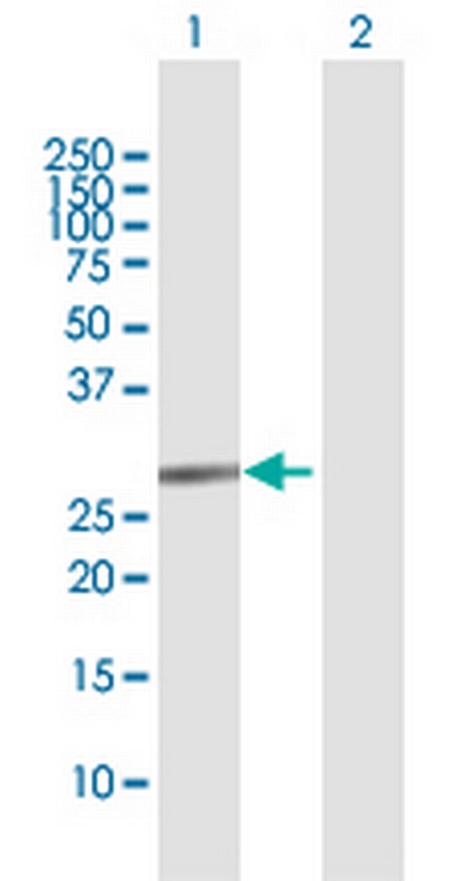TRIM72 Antibody in Western Blot (WB)