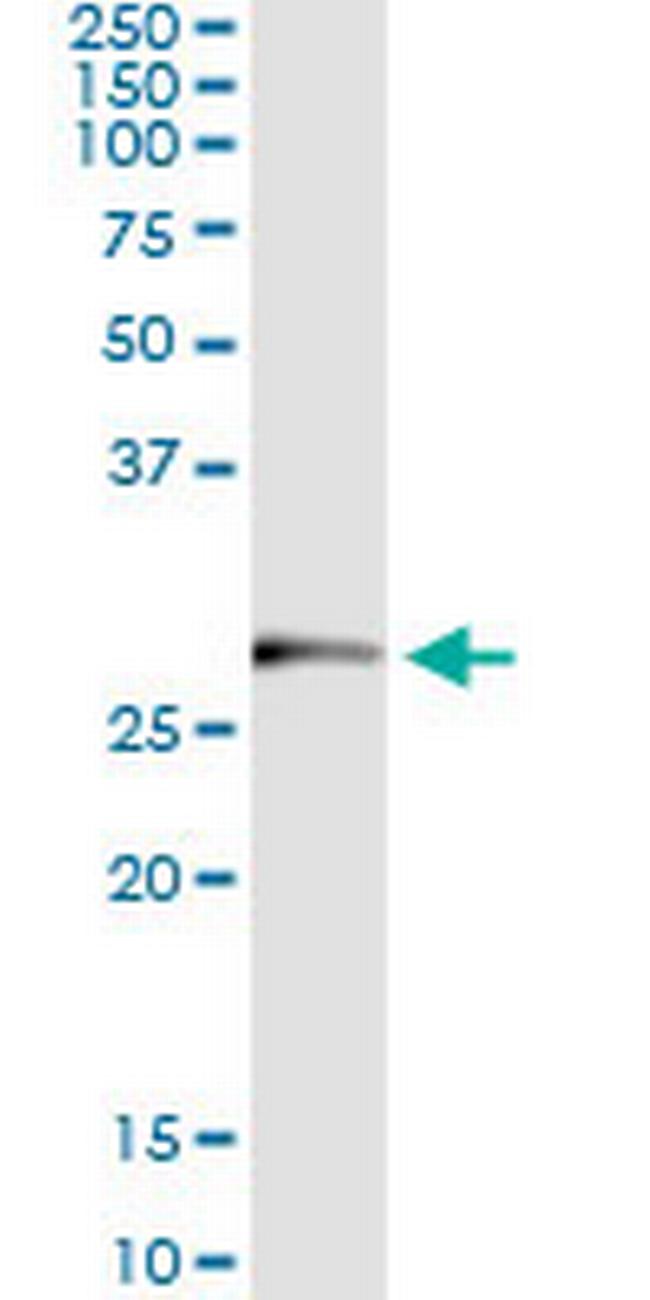 TRIM72 Antibody in Immunoprecipitation (IP)