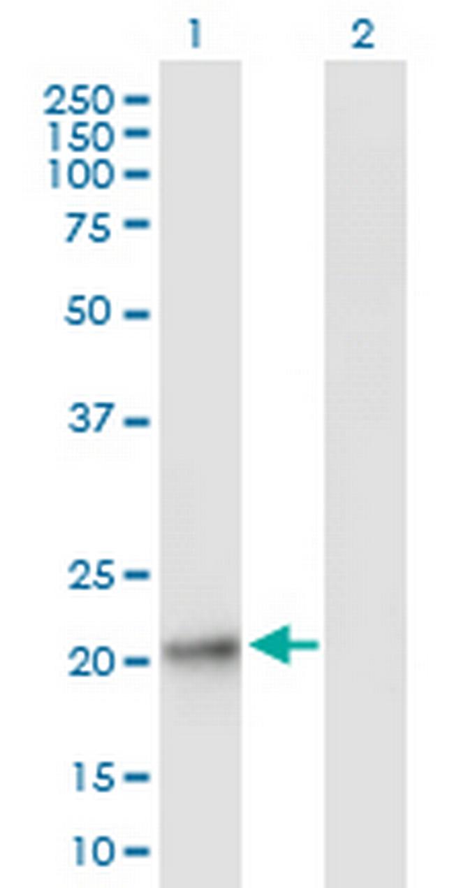 GPX8 Antibody in Western Blot (WB)