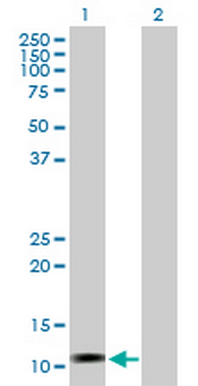 LOC541473 Antibody in Western Blot (WB)