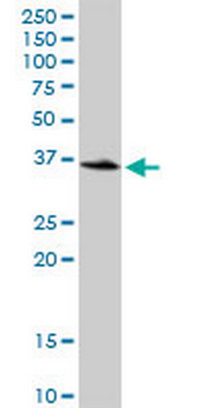 LOC541473 Antibody in Western Blot (WB)