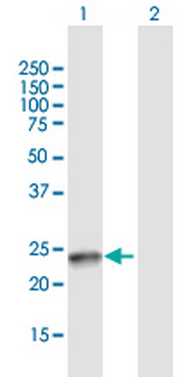 SSX4B Antibody in Western Blot (WB)