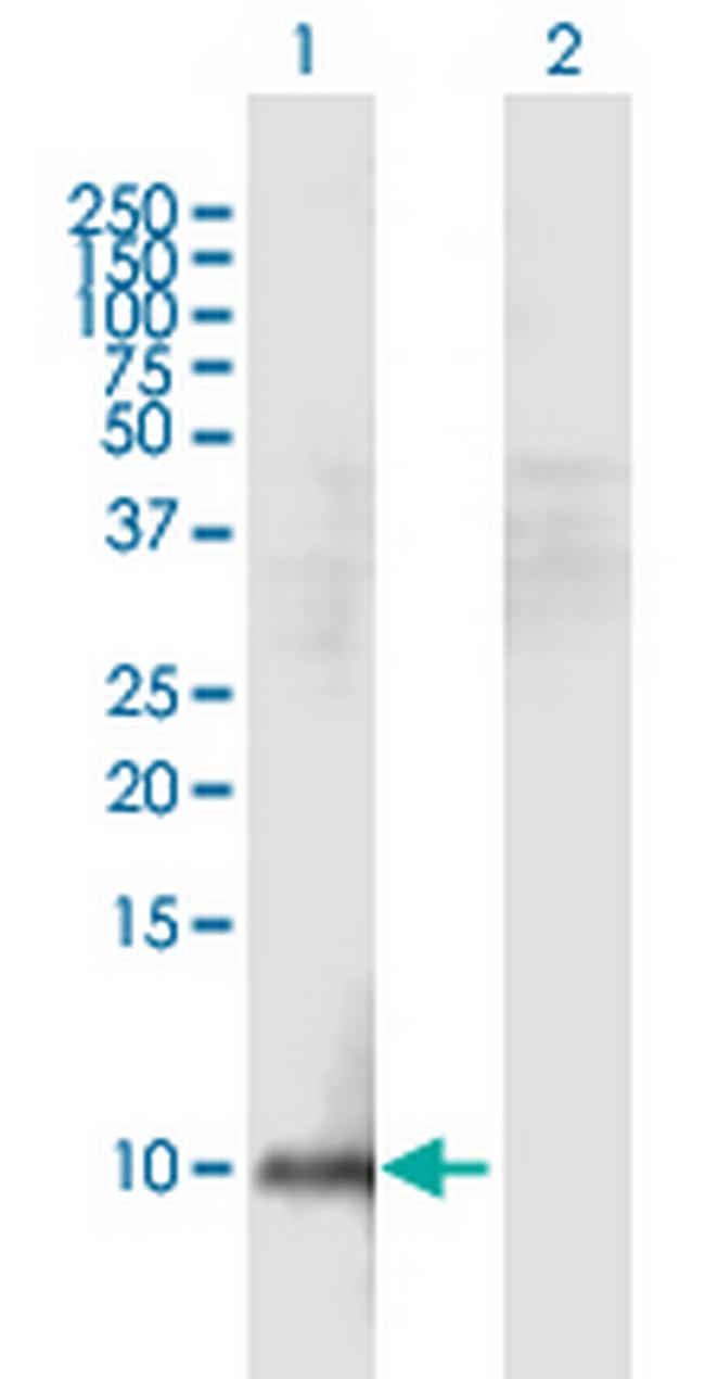 HEPN1 Antibody in Western Blot (WB)