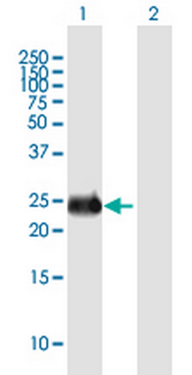 INS-IGF2 Antibody in Western Blot (WB)