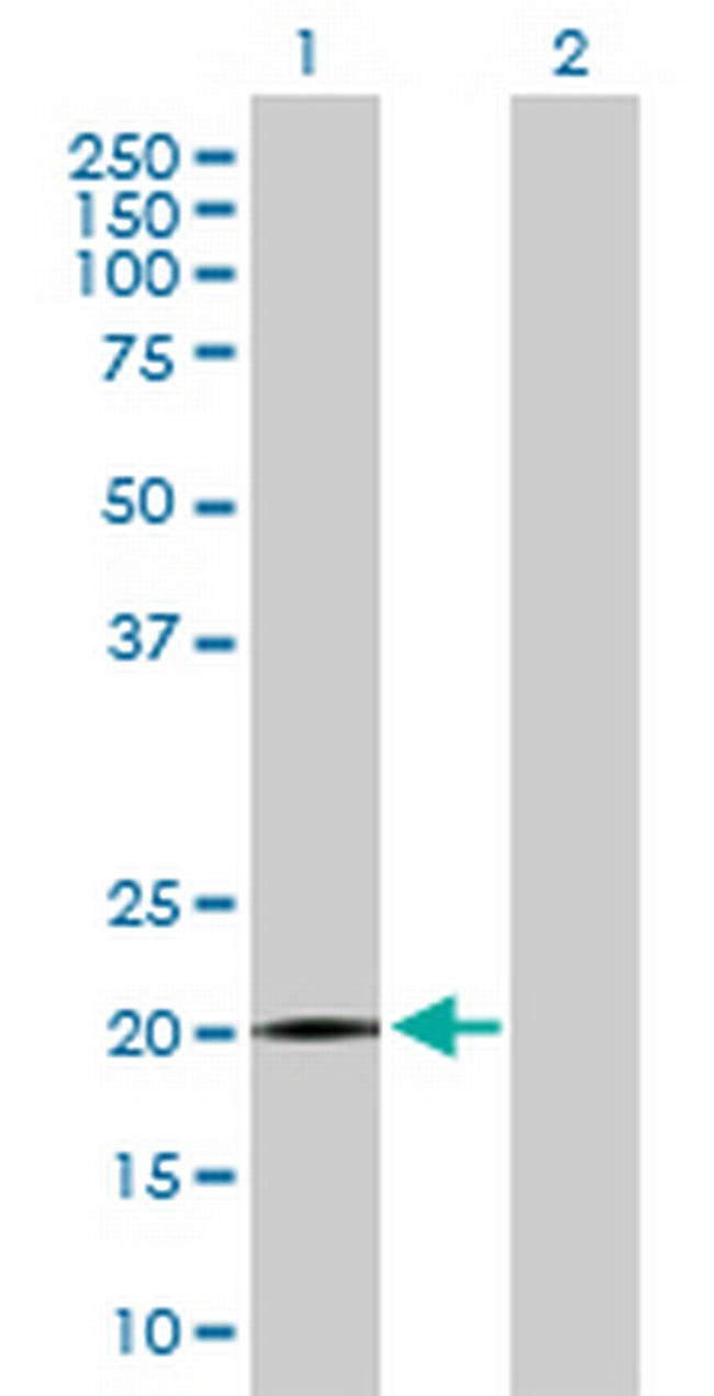 SPANXB1 Antibody in Western Blot (WB)