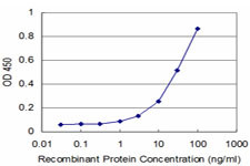 MEF2BNB Antibody in ELISA (ELISA)