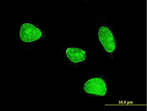 MEF2BNB Antibody in Immunocytochemistry (ICC/IF)