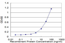 MEF2BNB Antibody in ELISA (ELISA)