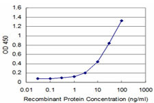 MEF2BNB Antibody in ELISA (ELISA)