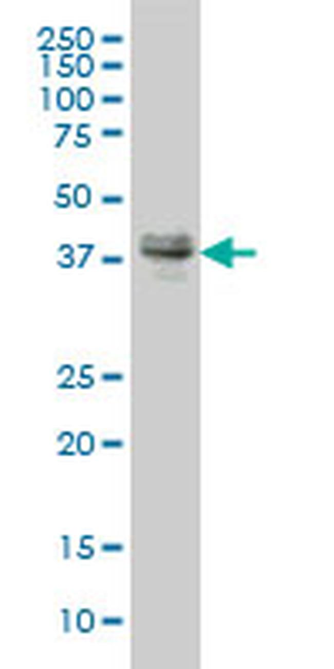 MEF2BNB Antibody in Western Blot (WB)