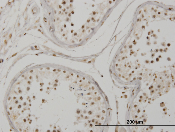 MEF2BNB Antibody in Immunohistochemistry (Paraffin) (IHC (P))