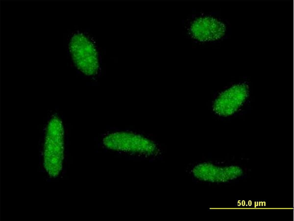 MEF2BNB Antibody in Immunocytochemistry (ICC/IF)