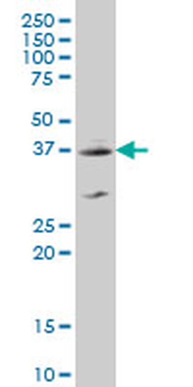 MEF2BNB Antibody in Western Blot (WB)