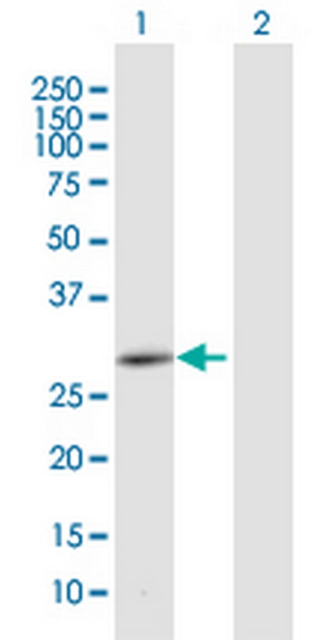 CEMP1 Antibody in Western Blot (WB)