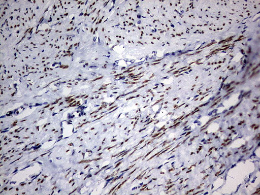 H2AFY2 Antibody in Immunohistochemistry (Paraffin) (IHC (P))