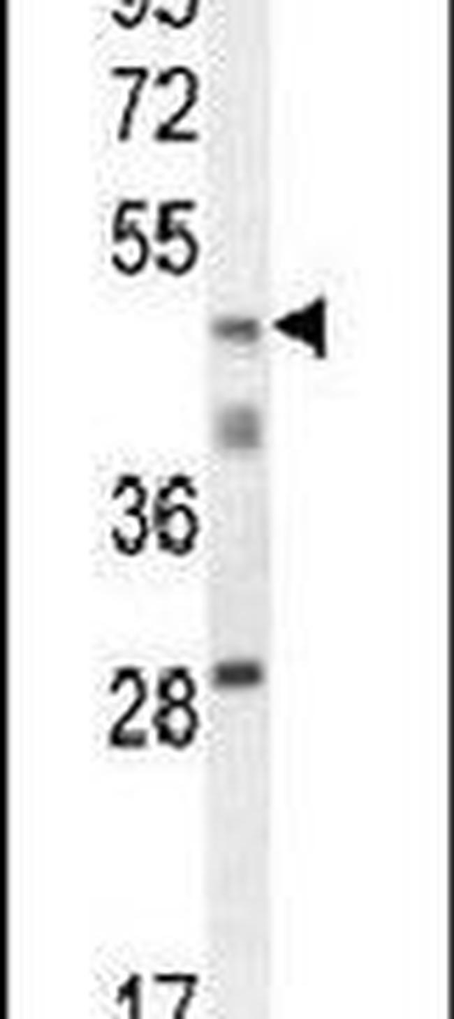 Macro H2A.2 Antibody in Western Blot (WB)