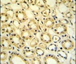 H6PD Antibody in Immunohistochemistry (IHC)