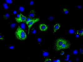 H6PD Antibody in Immunocytochemistry (ICC/IF)
