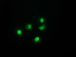 H6PD Antibody in Immunocytochemistry (ICC/IF)