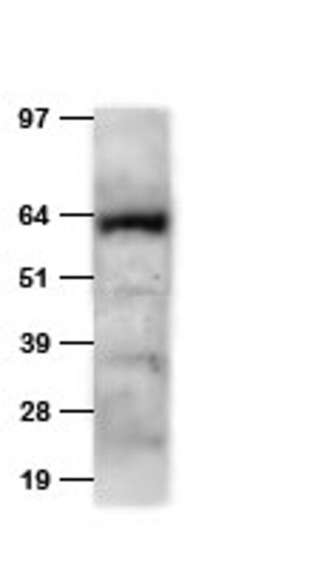 HA tag Antibody in Western Blot (WB)