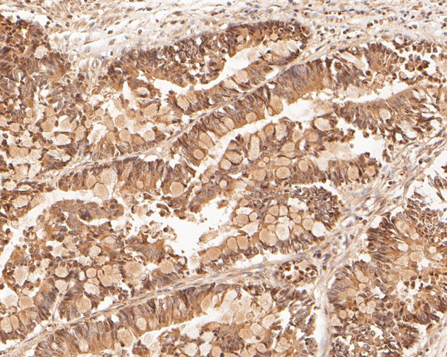 LSS Antibody in Immunohistochemistry (Paraffin) (IHC (P))