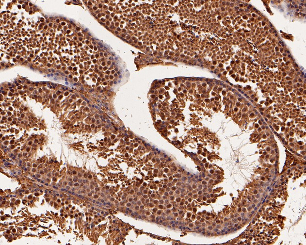 BRCA1 Antibody in Immunohistochemistry (Paraffin) (IHC (P))