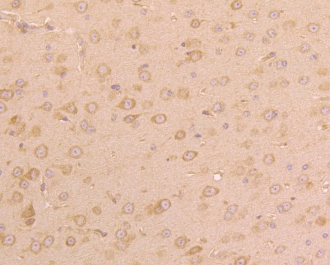 UGGT1 Antibody in Immunohistochemistry (Paraffin) (IHC (P))