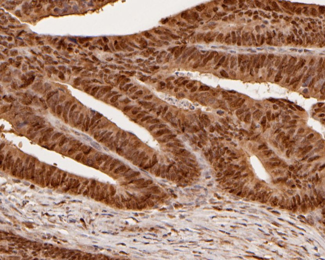 MAT2A Antibody in Immunohistochemistry (Paraffin) (IHC (P))