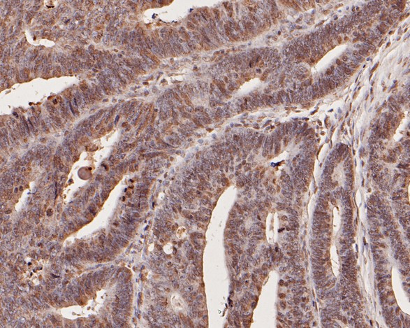 CCL2/MCP1 Antibody in Immunohistochemistry (Paraffin) (IHC (P))