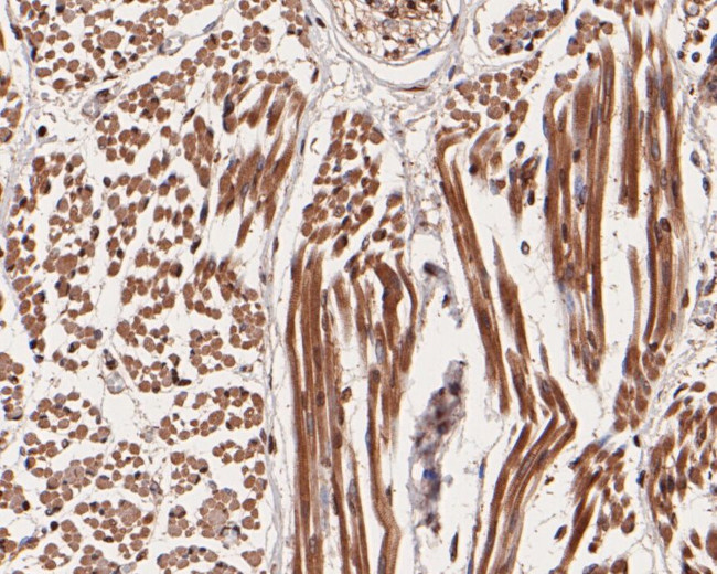 Smg1 Antibody in Immunohistochemistry (Paraffin) (IHC (P))