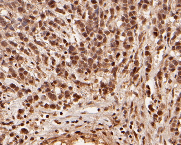 CREBBP Antibody in Immunohistochemistry (Paraffin) (IHC (P))