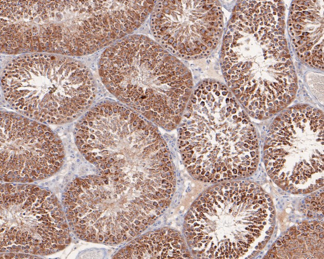 AKT2 Antibody in Immunohistochemistry (Paraffin) (IHC (P))