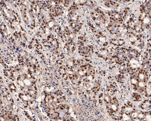 hnRNP L Antibody in Immunohistochemistry (Paraffin) (IHC (P))
