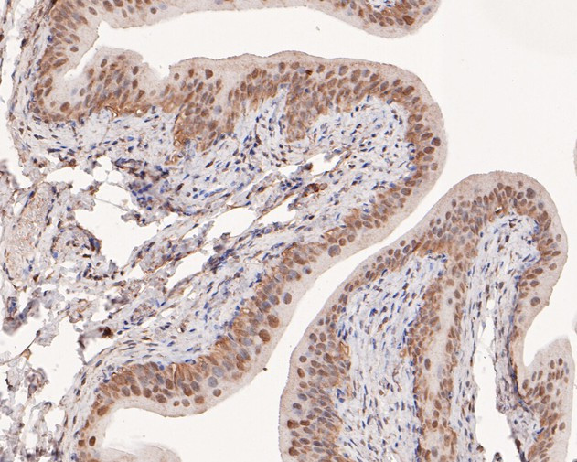 PPP2R4 Antibody in Immunohistochemistry (Paraffin) (IHC (P))
