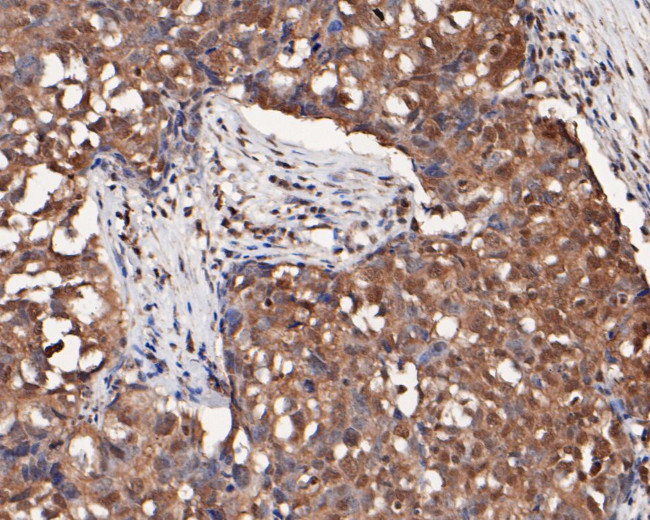 mTOR Antibody in Immunohistochemistry (Paraffin) (IHC (P))
