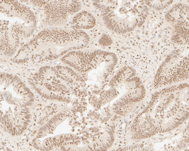 HNRPDL Antibody in Immunohistochemistry (Paraffin) (IHC (P))