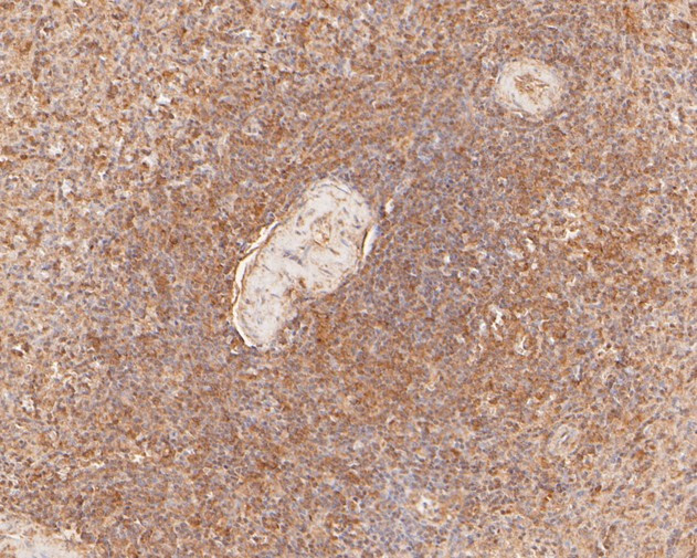 FLI1 Antibody in Immunohistochemistry (Paraffin) (IHC (P))