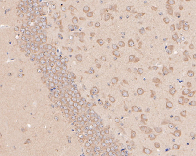 GNB3 Antibody in Immunohistochemistry (Paraffin) (IHC (P))