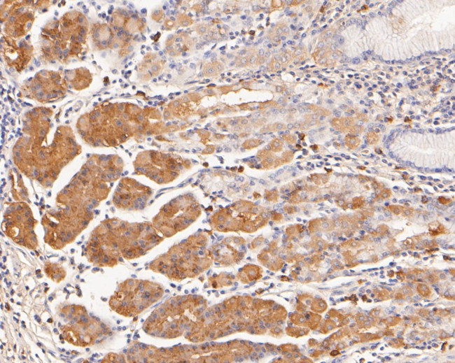 Histamine H2 receptor Antibody in Immunohistochemistry (Paraffin) (IHC (P))